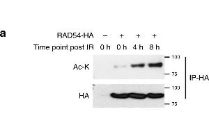 Western Blotting (WB) image for anti-Acetylated Lysine antibody (ABIN5596809)