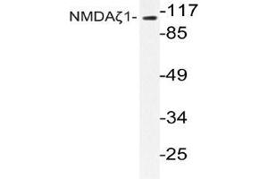Western blot (WB) analyzes of NMDAζ1 antibody in extracts from Jurkat cells.