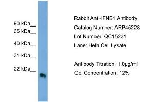 WB Suggested Anti-IFNB1  Antibody Titration: 0. (IFNB1 antibody  (Middle Region))