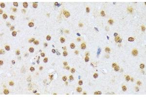 Immunohistochemistry of paraffin-embedded Mouse brain using A1CF Polyclonal Antibody at dilution of 1:100 (40x lens). (A1CF antibody)