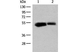Western blot analysis of Mouse liver tissue and Rat liver tissue lysates using GLUD1 Polyclonal Antibody at dilution of 1:200 (GLUD1 antibody)