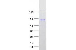 Validation with Western Blot (FAM134B Protein (Transcript Variant 2) (Myc-DYKDDDDK Tag))