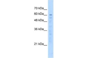 Western Blotting (WB) image for anti-EF-hand calcium binding domain 14 (EFCAB14) antibody (ABIN2463041) (KIAA0494 antibody)