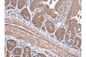 IHC-P Image ECH1 antibody [N1C3] detects ECH1 protein at cytoplasm in mouse intestine by immunohistochemical analysis. (ECHS1 antibody)