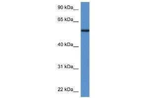 Western Blot showing PGM5 antibody used at a concentration of 1 ug/ml against Fetal Heart Lysate (Phosphoglucomutase 5 antibody  (N-Term))