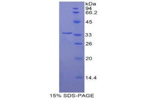 SDS-PAGE (SDS) image for Hepcidin Antimicrobial Peptide (HAMP) (AA 23-82) protein (His tag,GST tag) (ABIN1877716) (Hepcidin Protein (AA 23-82) (His tag,GST tag))
