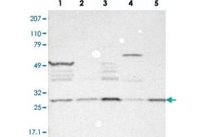 Western blot analysis of Lane 1: RT-4, Lane 2: EFO-21, Lane 3: A-431, Lane 4: Liver, Lane 5: Tonsil with FAM109B polyclonal antibody . (FAM109B antibody)