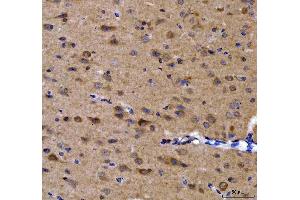 IHC analysis of GRB10 using anti-GRB10 antibody (ABIN7599160).
