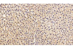 Immunohistochemistry (IHC) image for anti-Fibroblast Growth Factor 2 (Basic) (FGF2) (AA 159-288) antibody (ABIN7431986)