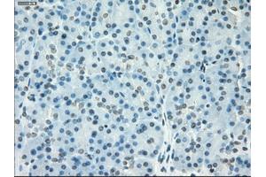 Immunohistochemical staining of paraffin-embedded colon tissue using anti-SSX2mouse monoclonal antibody.