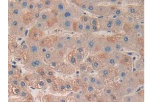 DAB staining on IHC-P; Samples: Human Liver Tissue (MAPKAP Kinase 3 antibody  (AA 129-329))
