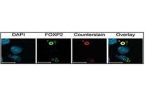 Characterization of FOXP2 isoforms using FOXP2 Ab (green) and Ubiquitin antibody (aggresome marker) (red). (Ubiquitin antibody  (AA 36-66))