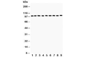 Western blot testing of CBL antibody (0. (CBL antibody  (AA 556-906))
