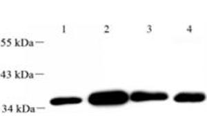 Western blot analysis of FLJ22167 (ABIN7073961) at dilution of 1: 2000,Lane 1: Mouse uterus tissue lysate,Lane 2: Mouse lung tissue lysate,Lane 3: Mouse ovary tissue lysate,Lane 4: Rat ovary tissue lysate (FLJ22167 antibody)