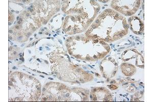Immunohistochemical staining of paraffin-embedded Human Kidney tissue using anti-BIRC5 mouse monoclonal antibody.