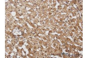 Immunostaining (ISt) image for anti-Cytochrome P450, Family 2, Subfamily E, Polypeptide 1 (CYP2E1) (AA 1-493) antibody (ABIN514836)