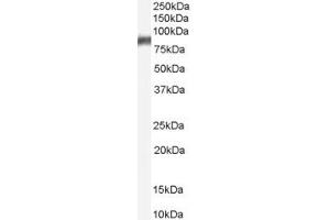 Western Blotting (WB) image for anti-Arachidonate 5-Lipoxygenase (ALOX5) (AA 651-666) antibody (ABIN292658)
