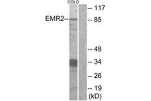 Western blot analysis of extracts from COLO cells, using EMR2 Antibody. (EMR2 antibody  (AA 765-814))