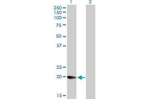 Western Blot analysis of DHRS11 expression in transfected 293T cell line by DHRS11 MaxPab polyclonal antibody. (DHRS11 antibody  (AA 1-181))