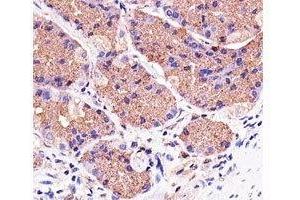 Immunohistochemical analysis of paraffin-embedded human stomach using Pink1 antibody at 1:25 dilution.