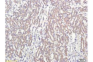 Formalin-fixed and paraffin embedded: rat kidney labeled with Anti-Thrombomodulin/CD141 Polyclonal Antibody, Unconjugated (ABIN669636) at 1:300 followed by conjugation to the secondary antibody and DAB staining (Thrombomodulin antibody)