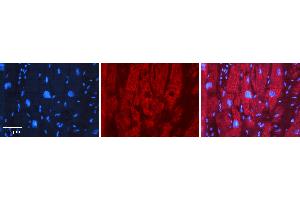 Rabbit Anti-EFEMP1 Antibody   Formalin Fixed Paraffin Embedded Tissue: Human heart Tissue Observed Staining: Cytoplasmic Primary Antibody Concentration: 1:100 Other Working Concentrations: 1:600 Secondary Antibody: Donkey anti-Rabbit-Cy3 Secondary Antibody Concentration: 1:200 Magnification: 20X Exposure Time: 0. (FBLN3 antibody  (Middle Region))