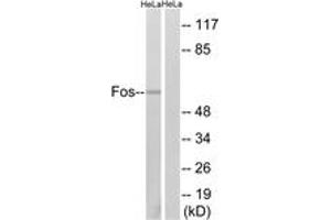 Western blot analysis of extracts from HeLa cells, using Fos (Ab-374) Antibody. (c-FOS antibody  (AA 331-380))