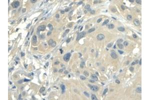 IHC-P analysis of Human Esophagus, with DAB staining. (ALDH1A2 antibody  (AA 1-422))