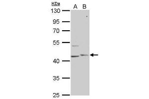 WB Image PHKG1 antibody [N1C3] detects PHKG1 protein by Western blot analysis. (PHKG1 antibody  (Center))