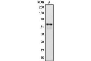 Western blot analysis of Cytochrome P450 2A6 expression in HepG2 (A) whole cell lysates. (CYP2A6 antibody  (Center))