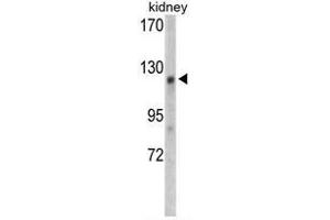 Western blot analysis of WTX antibody (Center) in mouse kidney tissue lysates (35ug/lane). (WTX antibody  (Middle Region))