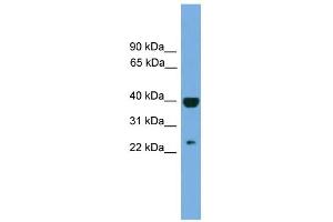 WB Suggested Anti-SOCS1 Antibody Titration:  0. (SOCS1 antibody  (Middle Region))