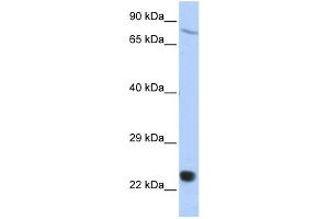 WB Suggested Anti-SAntibody Titration:  0. (SP110 antibody  (Middle Region))