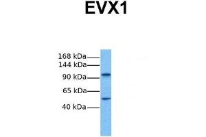 Host:  Rabbit  Target Name:  EVX1  Sample Tissue:  Human Fetal Lung  Antibody Dilution:  1. (EVX1 antibody  (N-Term))