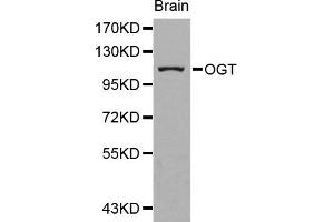 Western blot analysis of extracts of human brain cell line, using OGT antibody.