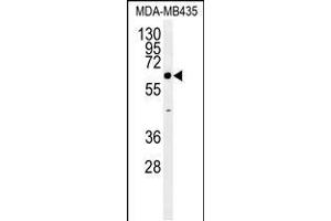 Western blot analysis in MDA-MB435 cell line lysates (35ug/lane). (ERO1LB antibody  (C-Term))