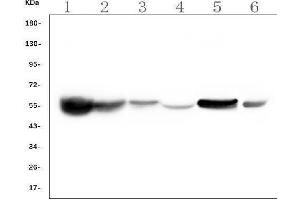 Western blot analysis of ALDH2 using anti-ALDH2 antibody (ABIN7603122).