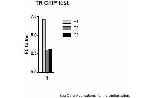 Image no. 2 for anti-Thyroid Hormone Receptor, beta (THRB) (N-Term) antibody (ABIN2779904) (THRB antibody  (N-Term))