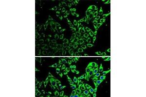 Immunofluorescence analysis of HeLa cells using Hsp60 Polyclonal Antibody (HSPD1 antibody)