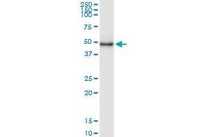 Immunoprecipitation of WDR19 transfected lysate using anti-WDR19 MaxPab rabbit polyclonal antibody and Protein A Magnetic Bead , and immunoblotted with WDR19 MaxPab mouse polyclonal antibody (B01) . (WDR19 antibody  (AA 1-437))