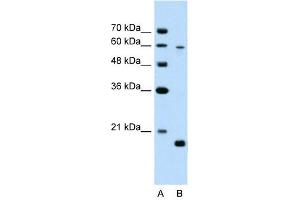 SLC38A4 antibody used at 2. (SLC38A4 antibody  (Middle Region))