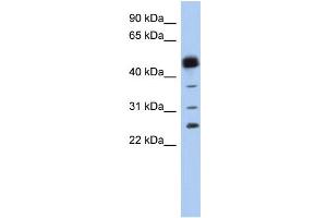 WB Suggested Anti-PGDS Antibody Titration:  0. (PTGDS antibody  (N-Term))