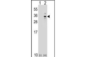 Western blot analysis of XBP1 (arrow) using rabbit polyclonal XBP1 Antibody (Center) (ABIN651279 and ABIN2840166). (XBP1 antibody  (AA 62-91))
