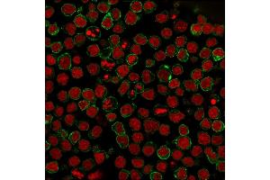 Immunofluorescent staining of paraformaldehyde-fixed Ramos cells using CD22-Monospecific Mouse Monoclonal Antibody (BLCAM/1795) followed by goat anti-Mouse IgG conjugated to CF488 (green). (CD22 antibody  (AA 52-178))