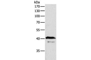 Western Blot analysis of Mouse brain tissue using ADAP1 Polyclonal Antibody at dilution of 1:500 (ADAP1 antibody)