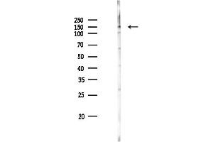 anti-ATP-Binding Cassette, Sub-Family C (CFTR/MRP), Member 3 (ABCC3) (Internal Region) antibody