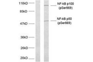 Western blot analysis of extracts from MDA-MB-435 cells treated with TNF-alpha, using NF-kappaB p100/p52 (Phospho-Ser869) Antibody. (NFKB2 antibody  (pSer870))