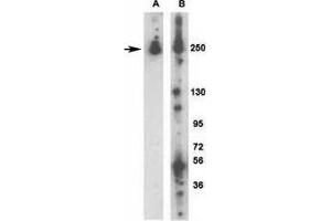 Western Blotting (WB) image for anti-Leucine-Rich Repeat Kinase 2 (LRRK2) (AA 931-962) antibody (ABIN3028794)