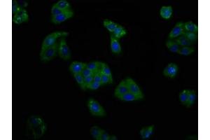Immunofluorescence staining of HepG2 cells with ABIN7164019 at 1:166, counter-stained with DAPI. (KCNV2 antibody  (AA 1-155))