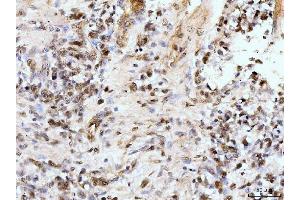 IHC analysis of IFI16 using anti-IFI16 antibody (ABIN7600374). (IFI16 antibody  (AA 183-743))